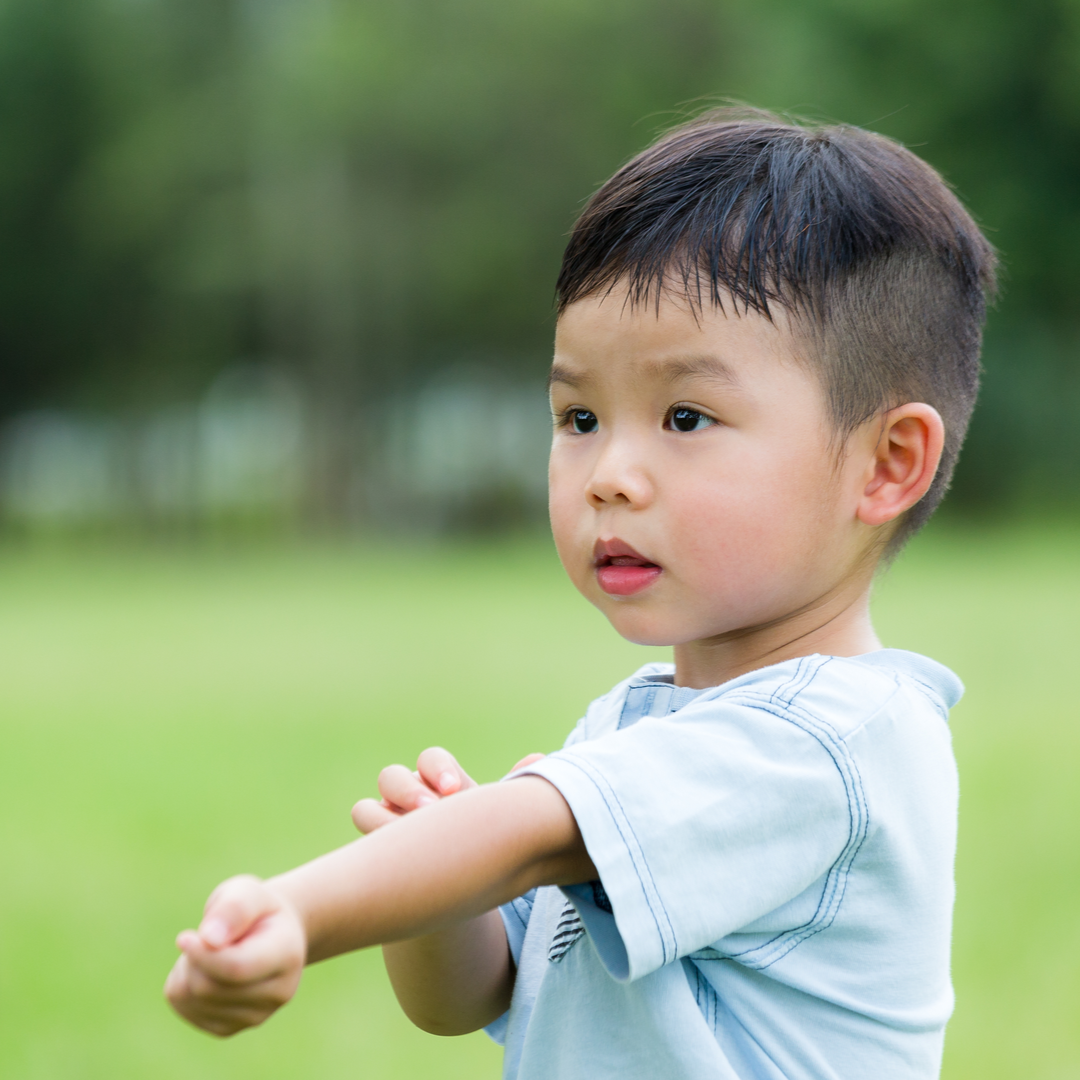 Atopic Derm boy stratching arm